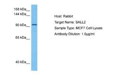 SALL2 Antibody, Novus Biologicals 100 &mu;L; Unconjugated:Antibodies, Polyclonal